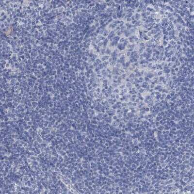 Immunohistochemistry-Paraffin: EAAT1/GLAST-1/SLC1A3 Antibody [NBP1-84939]