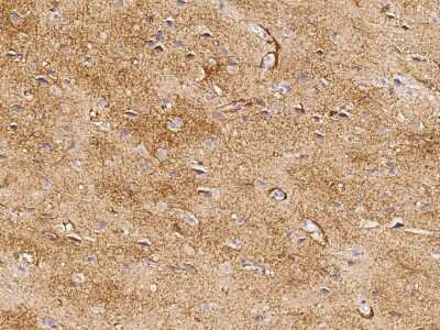 Immunohistochemistry-Paraffin: EAAT1/GLAST-1/SLC1A3 Antibody [NBP2-98747]