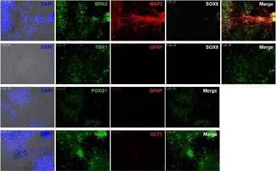 Immunocytochemistry/ Immunofluorescence: EAAT2/GLT1 Antibody - Azide Free [NBP1-20136]