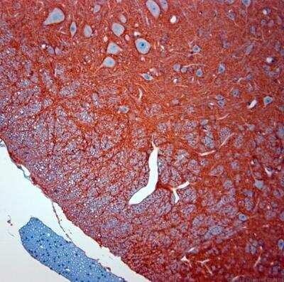 Immunohistochemistry-Paraffin: EAAT2/GLT1 Antibody - Azide Free [NBP1-20136]