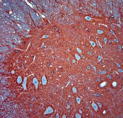 Immunohistochemistry-Paraffin: EAAT2/GLT1 Antibody - Azide Free [NBP1-20136]