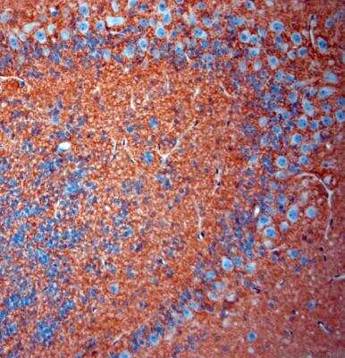 Immunohistochemistry-Paraffin: EAAT2/GLT1 Antibody - Azide Free [NBP1-20136]