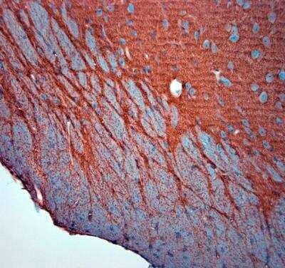 Immunohistochemistry-Paraffin: EAAT2/GLT1 Antibody - Azide Free [NBP1-20136]