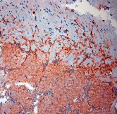 Immunohistochemistry-Paraffin: EAAT2/GLT1 Antibody - Azide Free [NBP1-20136]