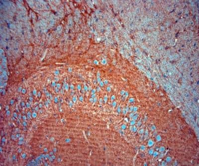 Immunohistochemistry-Paraffin: EAAT2/GLT1 Antibody - Azide Free [NBP1-20136]