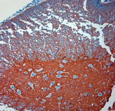 Immunohistochemistry-Paraffin: EAAT2/GLT1 Antibody - Azide Free [NBP1-20136]
