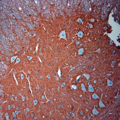 Immunohistochemistry-Paraffin: EAAT2/GLT1 Antibody - Azide Free [NBP1-20136]