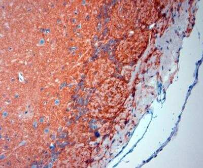 Immunohistochemistry-Paraffin: EAAT2/GLT1 Antibody - Azide Free [NBP1-20136]