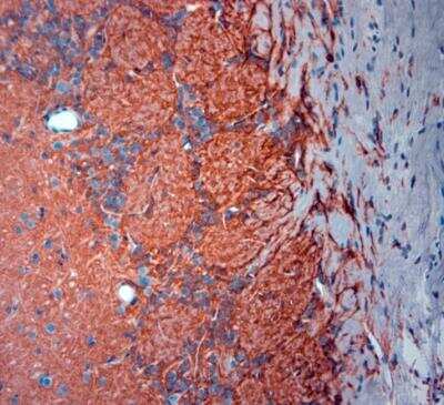 Immunohistochemistry-Paraffin: EAAT2/GLT1 Antibody - Azide Free [NBP1-20136]
