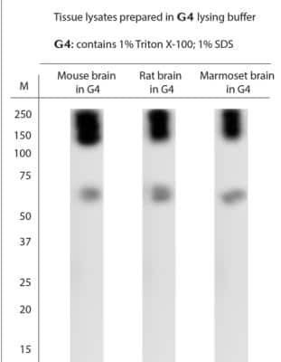 Western Blot: EAAT2/GLT1 AntibodyAzide Free [NBP1-20136]