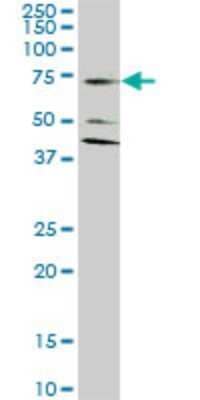 Western Blot: EAAT2/GLT1 Antibody (1D8) [H00006506-M07]