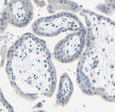 Immunohistochemistry-Paraffin: EAAT2/GLT1 Antibody [NBP1-84027]