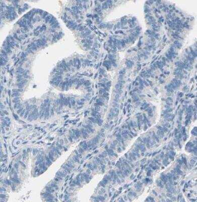 Immunohistochemistry-Paraffin: EAAT2/GLT1 Antibody [NBP1-84027]