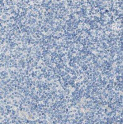 Immunohistochemistry-Paraffin: EAAT2/GLT1 Antibody [NBP1-84027]
