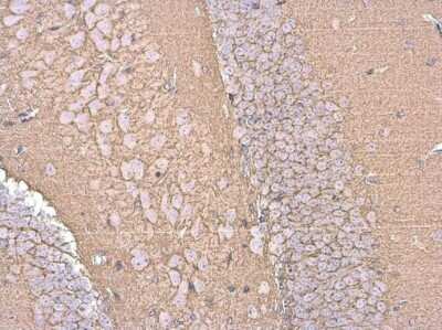 Immunohistochemistry-Paraffin: EAAT2/GLT1 Antibody [NBP3-13348]