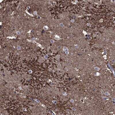 Immunohistochemistry-Paraffin: EAAT2/GLT1 Antibody [NBP3-17032]