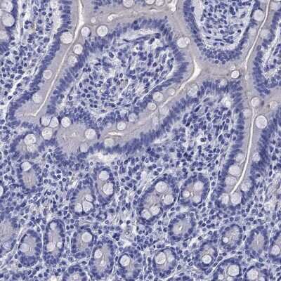 Immunohistochemistry-Paraffin: EAAT2/GLT1 Antibody [NBP3-17032]