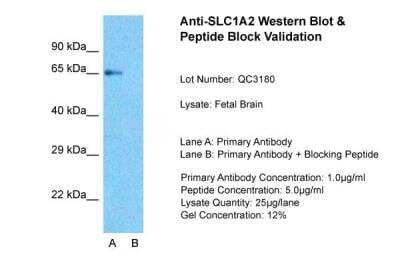 Western Blot: EAAT2/GLT1 Antibody [NBP1-59632]