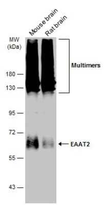 Western Blot: EAAT2/GLT1 Antibody [NBP3-13348]