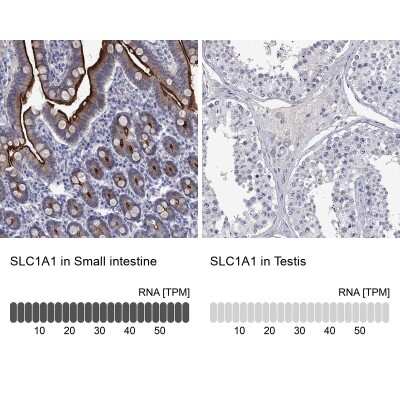 Immunocytochemistry/ Immunofluorescence: EAAT3 Antibody [NBP3-17050]