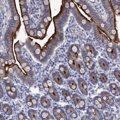 Immunohistochemistry-Paraffin: EAAT3 Antibody [NBP3-17050]