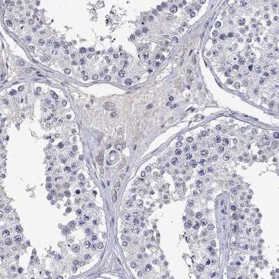 Immunohistochemistry-Paraffin: EAAT3 Antibody [NBP3-17050]