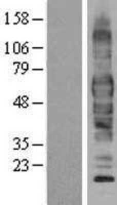 Western Blot: EAAT3 Overexpression Lysate [NBP2-04266]