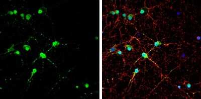 Immunocytochemistry/ Immunofluorescence: EAAT4 Antibody [NBP3-13360]