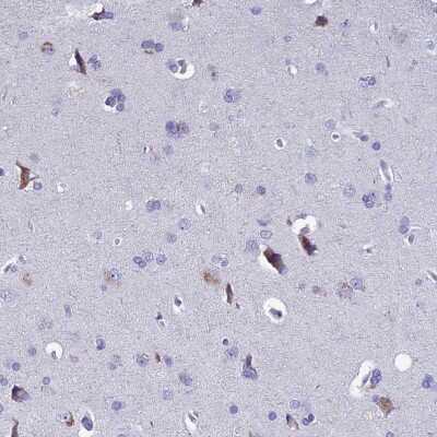 Immunohistochemistry-Paraffin: EAAT4 Antibody [NBP2-48740]