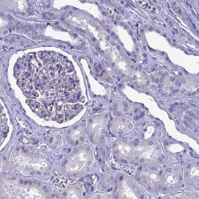 Immunohistochemistry-Paraffin: EAAT4 Antibody [NBP2-48740]