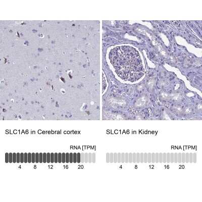 Immunohistochemistry-Paraffin: EAAT4 Antibody [NBP2-48740]