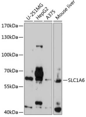 Western Blot: EAAT4 AntibodyBSA Free [NBP2-92419]