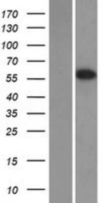 Western Blot: EAAT4 Overexpression Lysate [NBP2-10518]