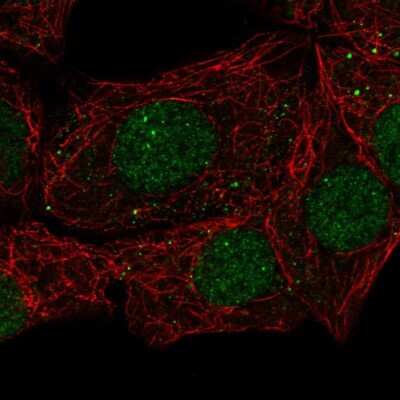 Immunocytochemistry/ Immunofluorescence: EAF1 Antibody [NBP2-57007]