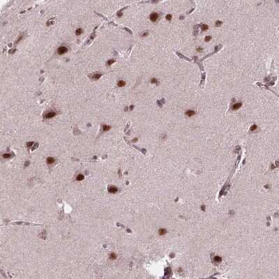 Immunohistochemistry-Paraffin: EAF1 Antibody [NBP2-49604]