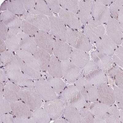 Immunohistochemistry-Paraffin: EAF1 Antibody [NBP2-49604]