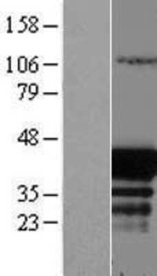 Western Blot: EAF1 Overexpression Lysate [NBL1-10087]