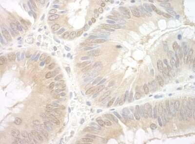 Immunohistochemistry: EAF2 Antibody [NBP1-80575]