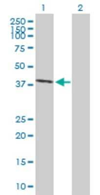 Western Blot: EAF2 Antibody [H00055840-B01P]