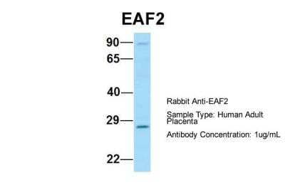 Western Blot: EAF2 Antibody [NBP2-86622]