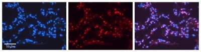 Immunohistochemistry-Paraffin: EAR2/NR2F6 Antibody [NBP2-86623]