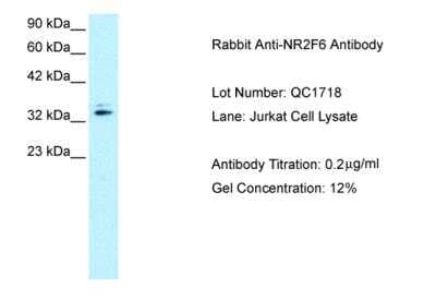 Western Blot: EAR2/NR2F6 Antibody [NBP2-86623]