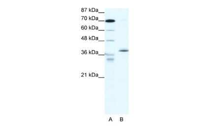 Western Blot: EAR2/NR2F6 Antibody [NBP2-86624]