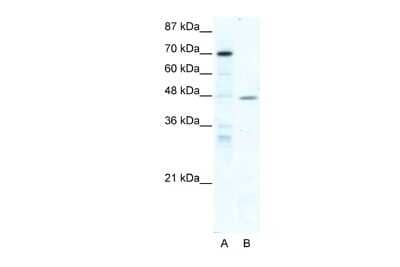 Western Blot: EAR2/NR2F6 Antibody [NBP2-86625]