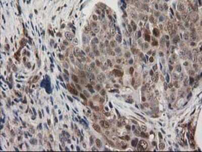 Immunohistochemistry-Paraffin: EB2 Antibody (OTI1F3) [NBP2-00714]