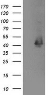 Western Blot: EB2 Antibody (OTI1F3) [NBP2-00714]