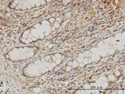 Immunohistochemistry-Paraffin: EB2 Antibody (4D7) [H00010982-M03]