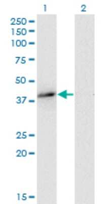 Western Blot: EB2 Antibody (4D7) [H00010982-M03]