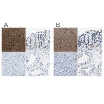 Immunohistochemistry-Paraffin: EB2 Antibody [NBP1-84926]