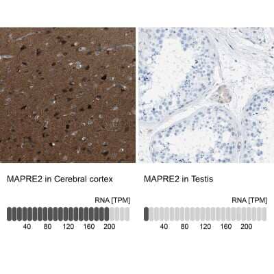 Immunohistochemistry-Paraffin: EB2 Antibody [NBP1-84926]